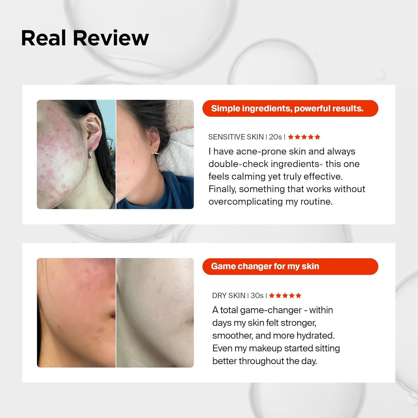 Revitalize Your Skin with Pixcell Biom Probiotic Essence Serum - 2 Billion Cultures for Acne-Prone & Sensitive Skin (1.01 Fl Oz)