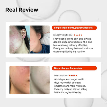 Revitalize Your Skin with Pixcell Biom Probiotic Essence Serum - 2 Billion Cultures for Acne-Prone & Sensitive Skin (1.01 Fl Oz)