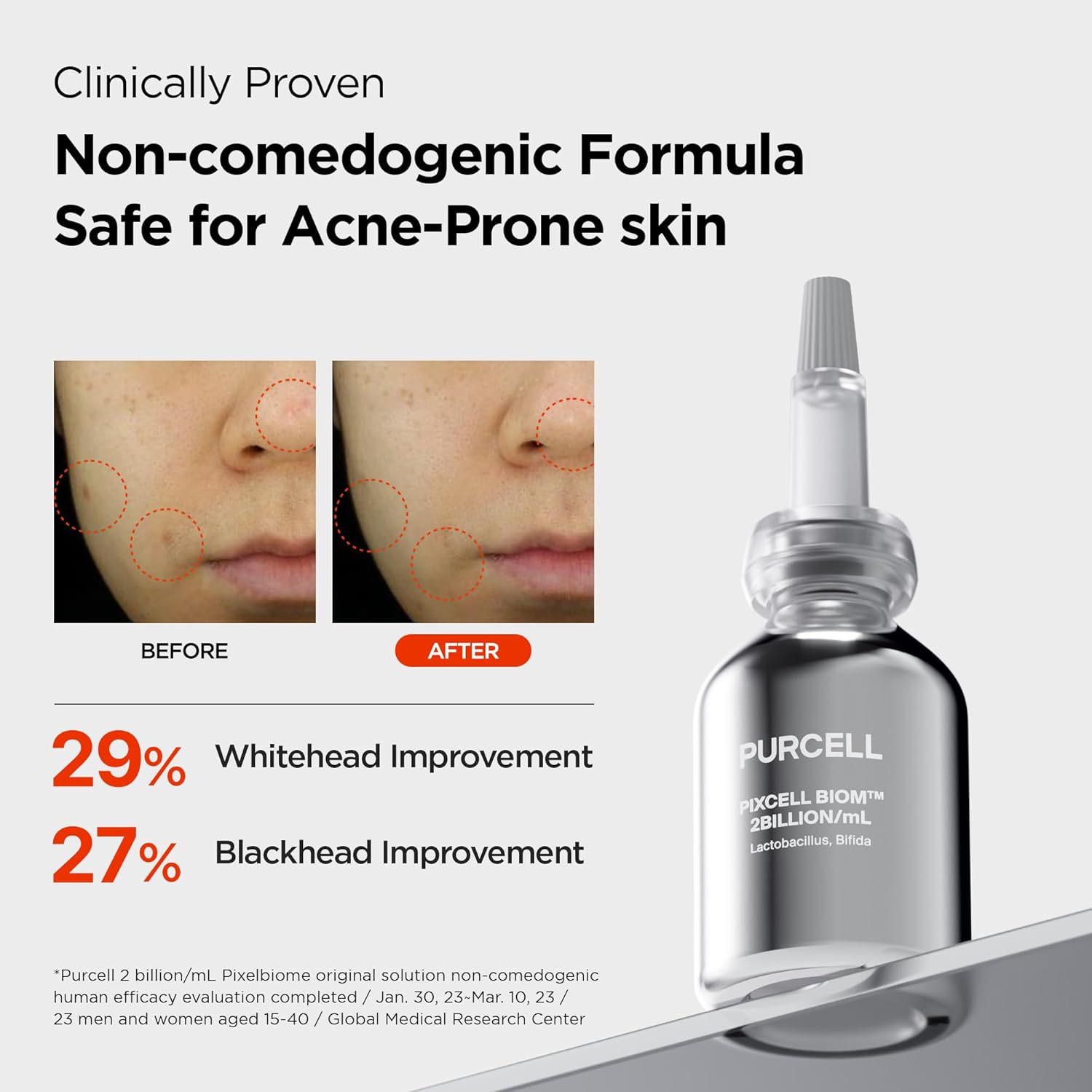 Revitalize Your Skin with Pixcell Biom Probiotic Essence Serum - 2 Billion Cultures for Acne-Prone & Sensitive Skin (1.01 Fl Oz)