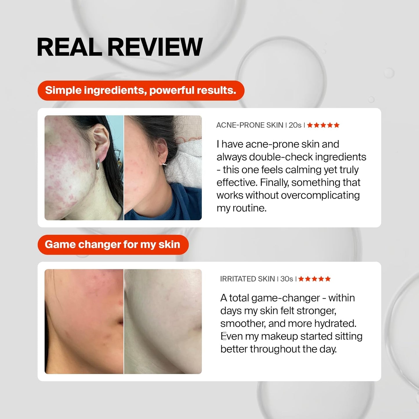Revitalize Your Skin with Pixcell Biom Probiotic Essence Serum - 2 Billion Cultures for Acne and Sensitive Skin Protection (1.85 Fl Oz)