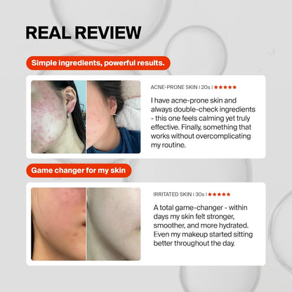 Revitalize Your Skin with Pixcell Biom Probiotic Essence Serum - 2 Billion Cultures for Acne and Sensitive Skin Protection (1.85 Fl Oz)