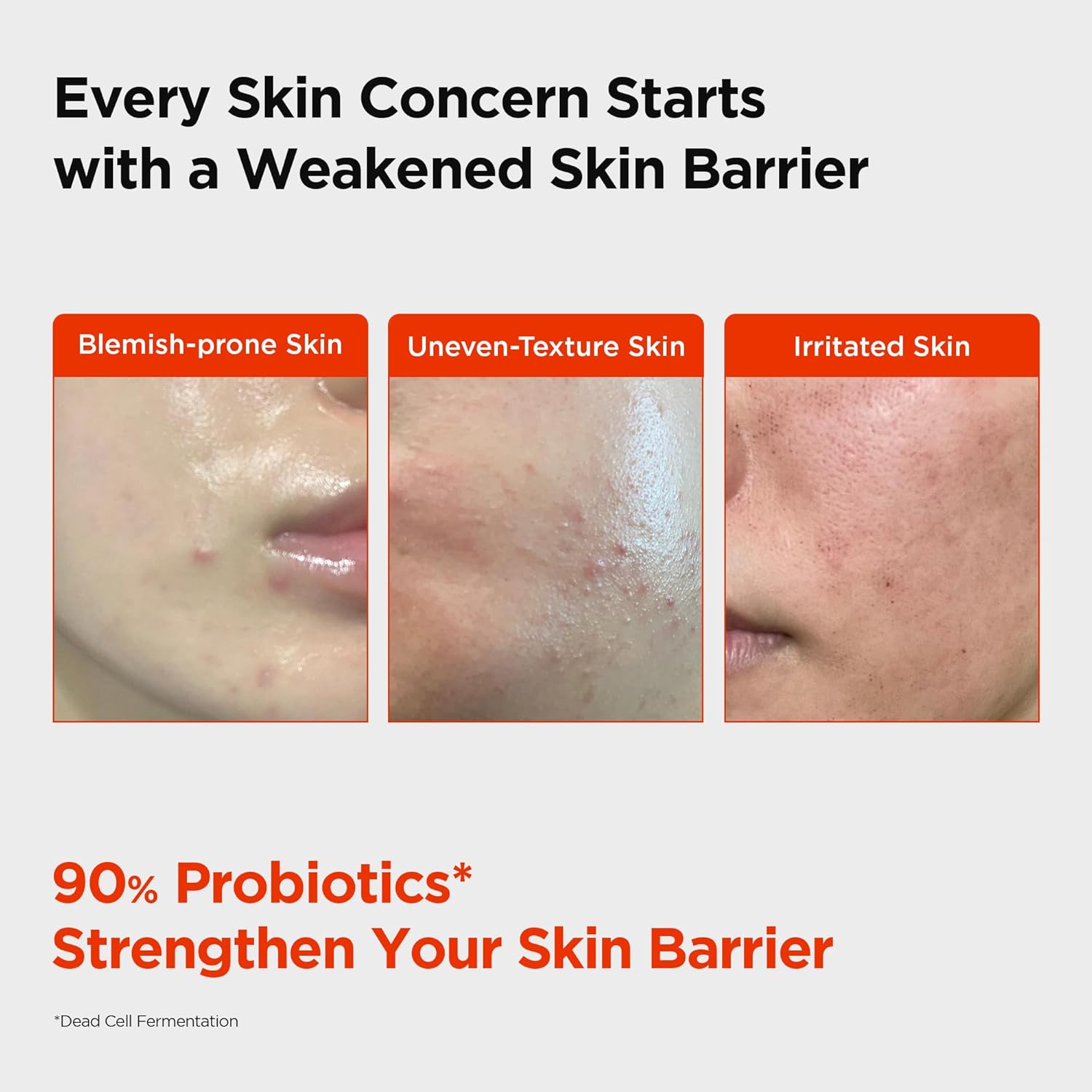 Revitalize Your Skin with Pixcell Biom Probiotic Essence Serum - 2 Billion Cultures for Acne-Prone & Sensitive Skin (1.01 Fl Oz)